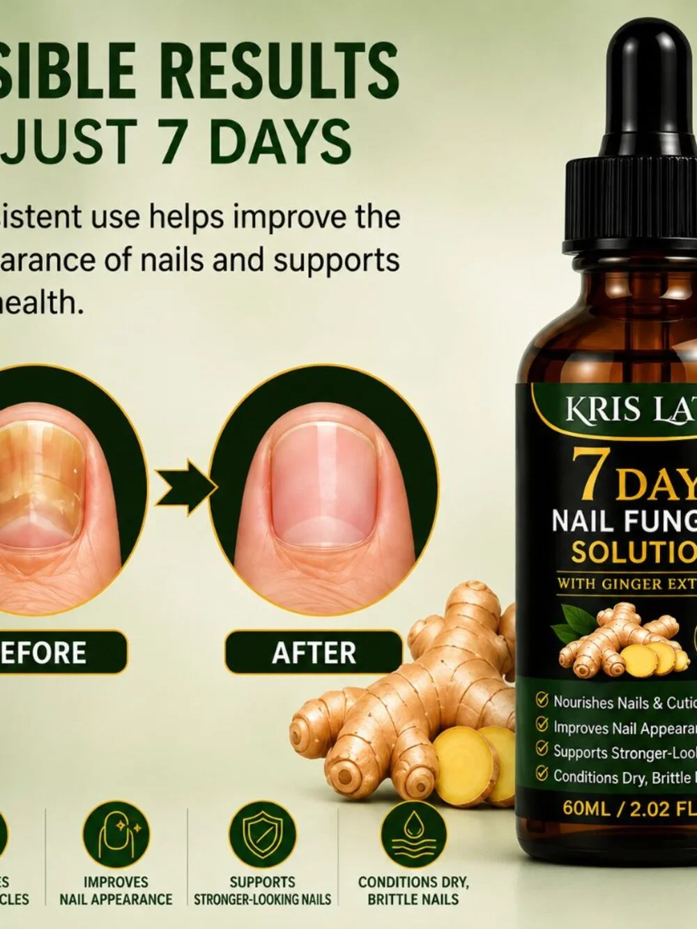 7 Days Nail Fungus Solution with Ginger Extract – 2.02 Fl Oz